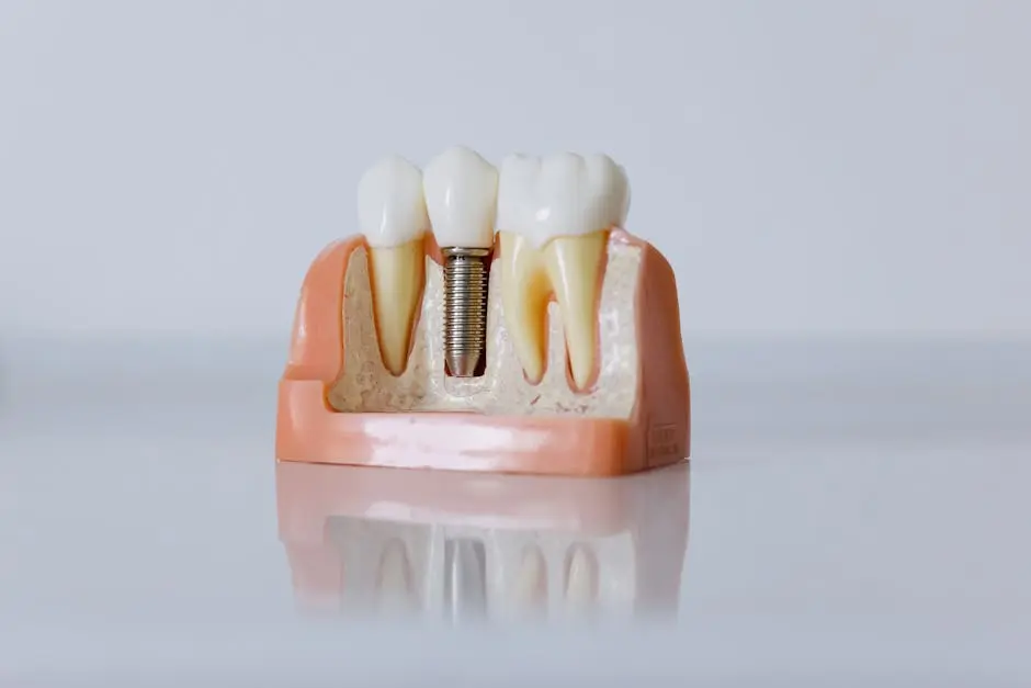 Implantes dentários em Niterói